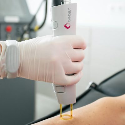 آموزش دستگاه لیزر